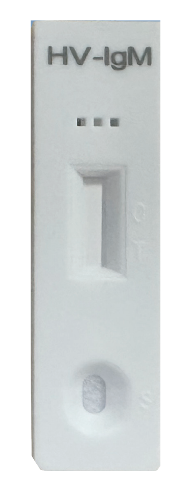 Hantavirus IgM rapid test cassette for antibody detection in clinical diagnostic testing
